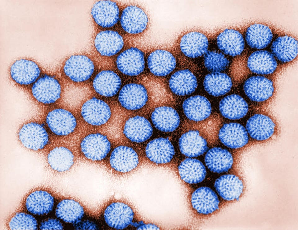 Rotavirus Surge in the United States: Essential Guide for Parents